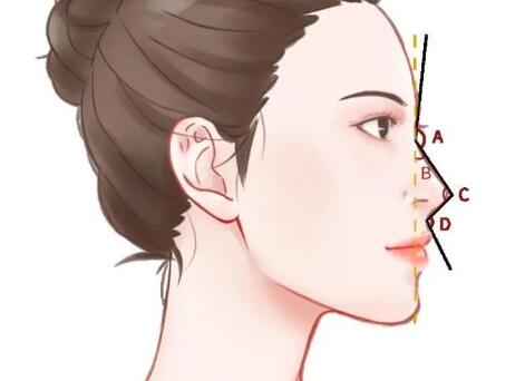 专业隆鼻整形手术怎么样？真实案例这里看