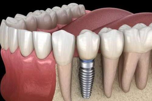 广州哪个牙科好又便宜？正规医院名单优选