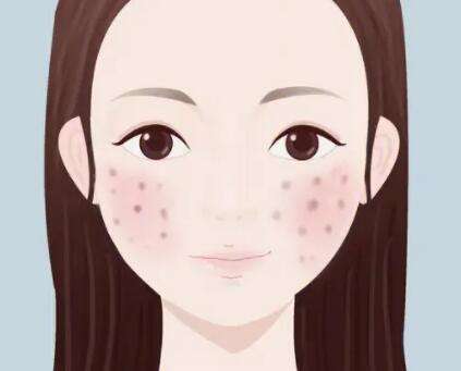 徐州矿务集团总医院祛痘多少钱？公布祛痘价格及医院信息严选