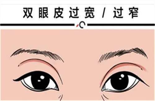 中山大学附属第一医院做双眼皮多少钱？人气医生介绍