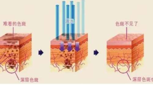 温州附一医祛斑专科怎么样？医院实力在线看