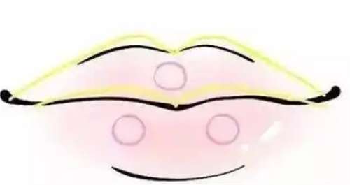 打嘟嘟唇大概多少钱？打嘟嘟唇恢复期多久？