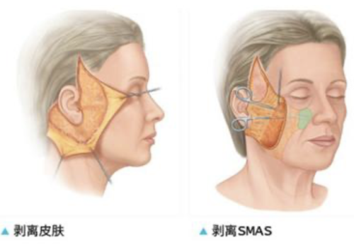 截屏2025-07-21 22.15.23.png