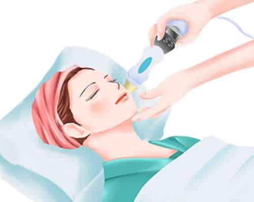 像素激光治疗痘疤怎么样?痘坑星人亲测效果太香了