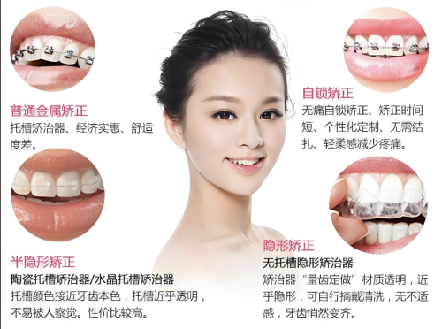 广医附属口腔矫正牙齿怎么样?真实患者实测:技术、服务、效果全解析