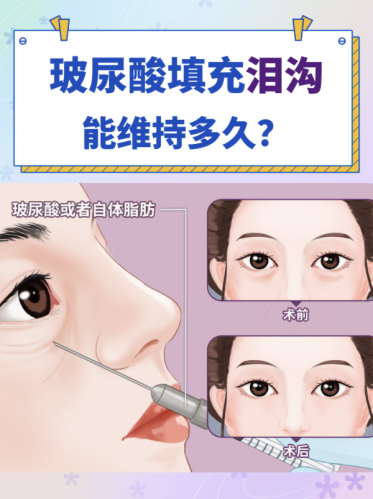 截屏2025-11-27 11.10.44.png