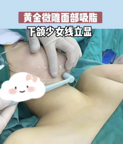 截屏2025-11-27 08.52.44.png