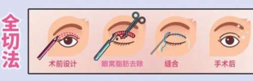 【整形医生咨询】整形医生免费咨询入口