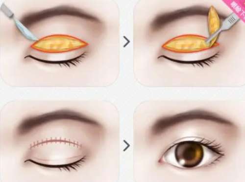 【整形美容在线咨询】整容医院医生预约