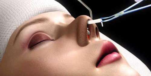 【重庆整形咨询】重庆整形医院医生免费在线咨询