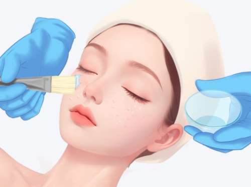 果酸换肤和光子嫩肤哪个效果好？看看核心差异和适用情况在哪