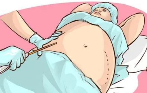 腰腹抽脂和手臂抽脂可以一起做吗？这几个前提条件你需要提前了解清楚