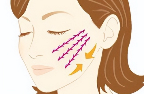 迷你小拉皮手术适合多大年龄？医生建议的适合年龄段与常见人群分析