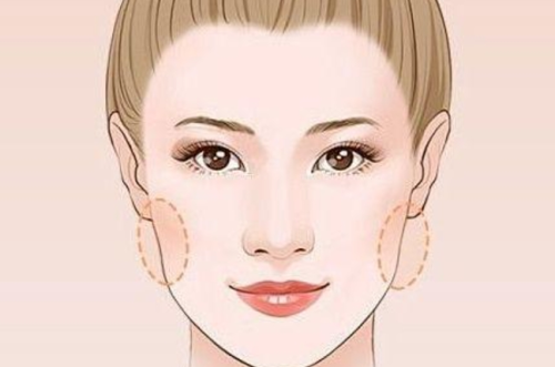 面颊凹陷填充玻尿酸能维持多久？玻尿酸维持周期＋补针节奏建议