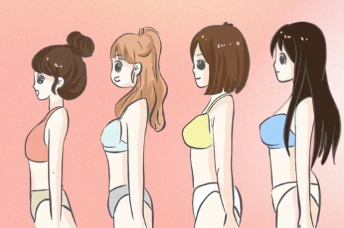 内窥镜隆胸和双平面隆胸区别，切口、恢复期、假体位置一次讲透