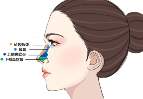 半肋骨鼻和全肋骨鼻哪个费用高？两种方案的价格区间和适合人群对比