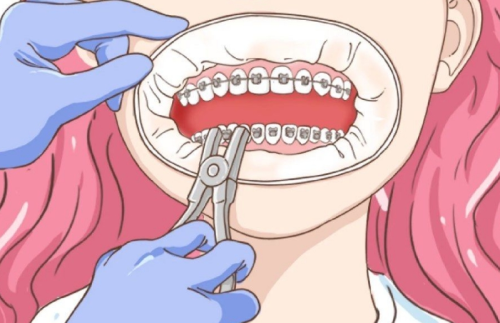 杭州第一人民医院矫正牙齿怎么样？技术水平+就诊体验评价