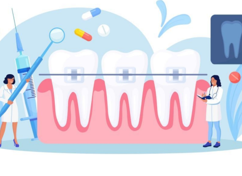 浙一牙齿矫正多少钱？附不同矫正方案的费用对比