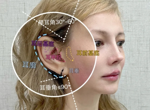 耳基底提升后遗症，几种常见后遗症的原因和应对