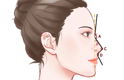 填高鼻梁哪种方法好？不同基础和诉求差别很大