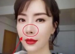 陈数有做过整容手术吗?整容前后对比图分享!