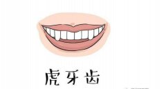 怎样判断虎牙和尖牙呢？拔掉老虎牙齿的更好时机是什么时间呢？