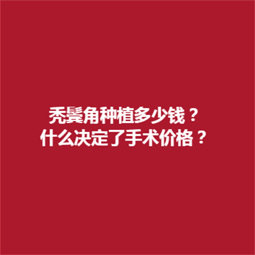 秃鬓角种植多少钱?决定价格的因素有哪些呢?可以促进来了解一下哦。