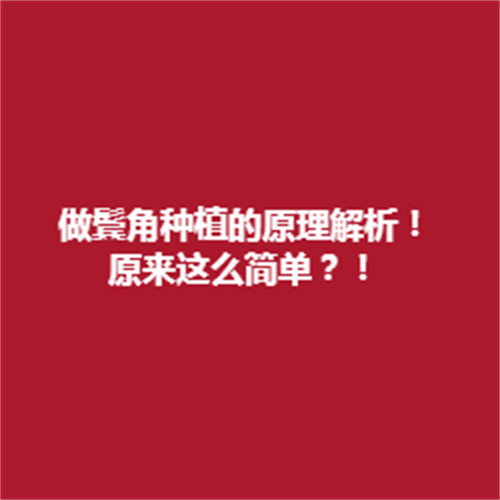 做鬓角种植的原理分析，种植技术吗?详细介绍参考一下吧!