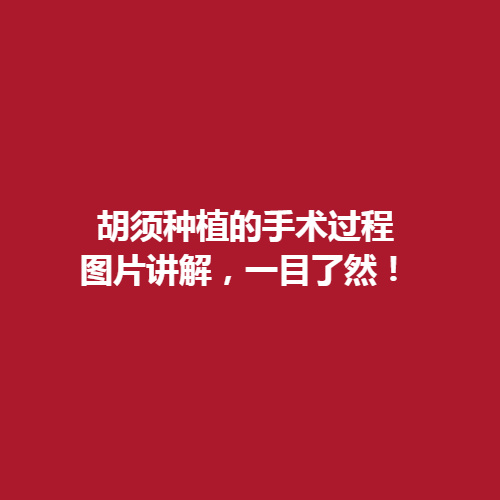胡须种植的手术过程图片讲解，一目了然，术后注意事项大全。