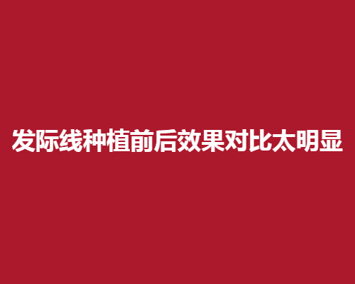 发际线种植前后X果对比太明X，加分X果很明X!种植后的X果怎么样呢?
