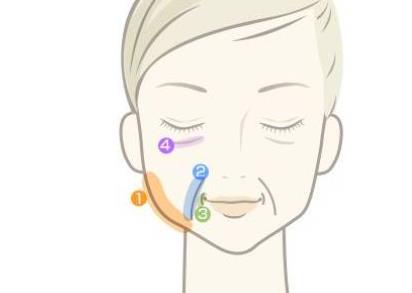 面部提升动漫4.jpg 面部提升动漫4.jpg