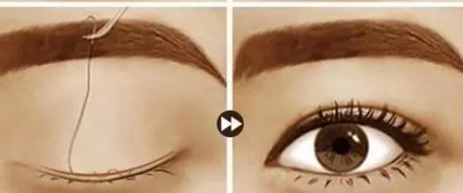 双眼皮动漫002.jpg 双眼皮动漫002.jpg