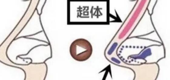 假体隆鼻的危害有哪些？做鼻整形手术前后需要注意哪些事情？
