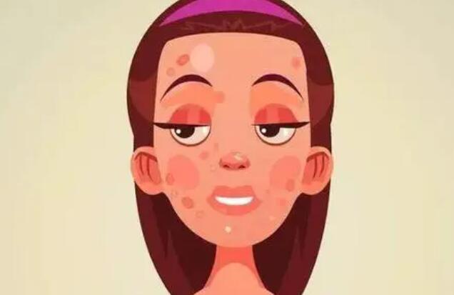 16个去除痘印的小妙招分享！果好不好？快戳进来看看吧！