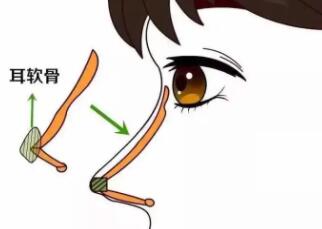 隆鼻1到7天恢复过程图片来袭！网友亲身经历：线条自然！