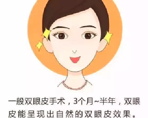 长沙张娇娇双眼皮果如何?公开案例分析!附医生详细信息!