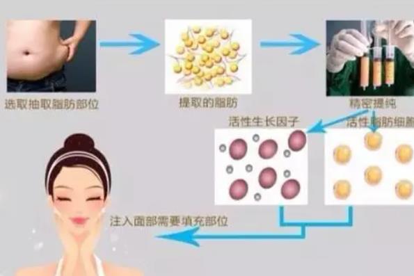 下巴动漫04.jpg