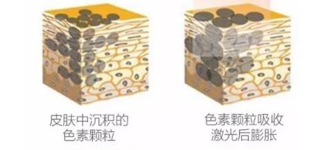 洗眉毛动漫01.jpg 洗眉毛动漫01.jpg