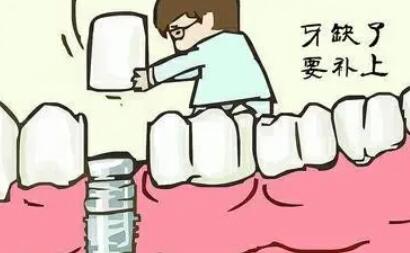 牙齿种植动漫.jpg 牙齿种植动漫.jpg