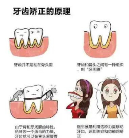 兰州大学口腔医院牙齿矫正怎么样?网友感受+价格表详情一览!