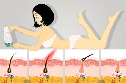 成都晶肤医院热玛吉怎么样?做完了热玛吉毛孔真的变小了