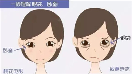 内切眼袋手术会影响视力吗?
