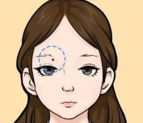 冷冻去痣和激光祛痣各有什么优缺点?