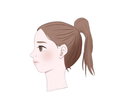 下颌角截骨术2.jpg
