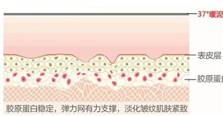 做热玛吉怎么样?哪些人适合