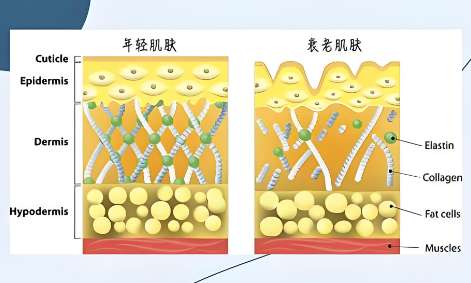 拉皮手术有什么后遗症?拉皮手术如何做好