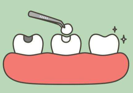 牙齿缺了一个角能补吗?补牙注意事项科普