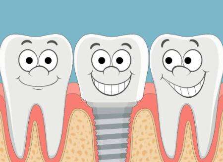 进口种植牙费用是多少？费用详情看这，别再花冤枉钱