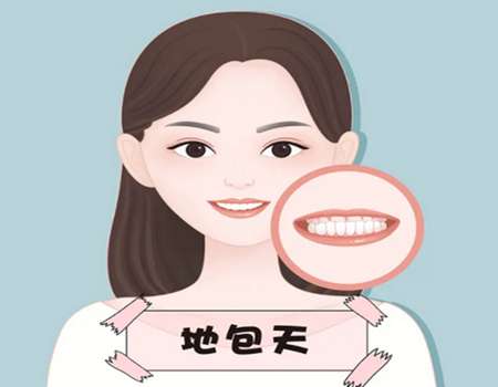 地包天是怎样形成的?看看项目原理+解决方式了解