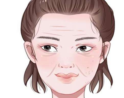 锯齿线悬吊除皱术怎么样?点击了解热门项目简介